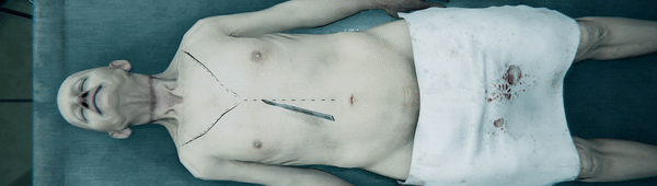 验尸模拟器/Autopsy Simulator（更新v153.413）(图3)