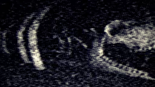 铁肺/Iron Lung(图2) 铁肺/Iron Lung(图2)